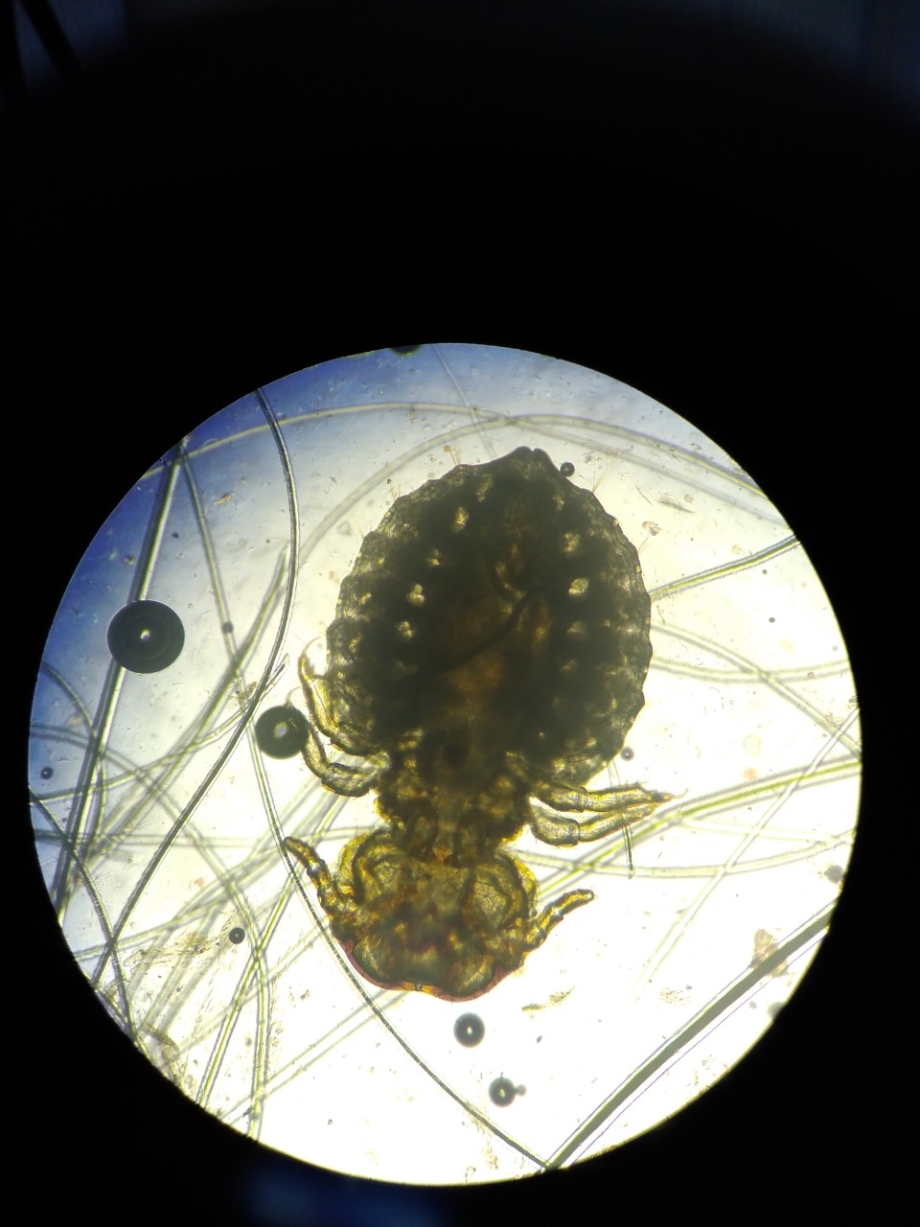Ascaris lumbricoides, necator americanus и Ancylostoma duodenale.