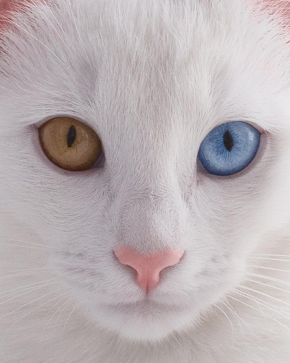 Heterochromia Iridis