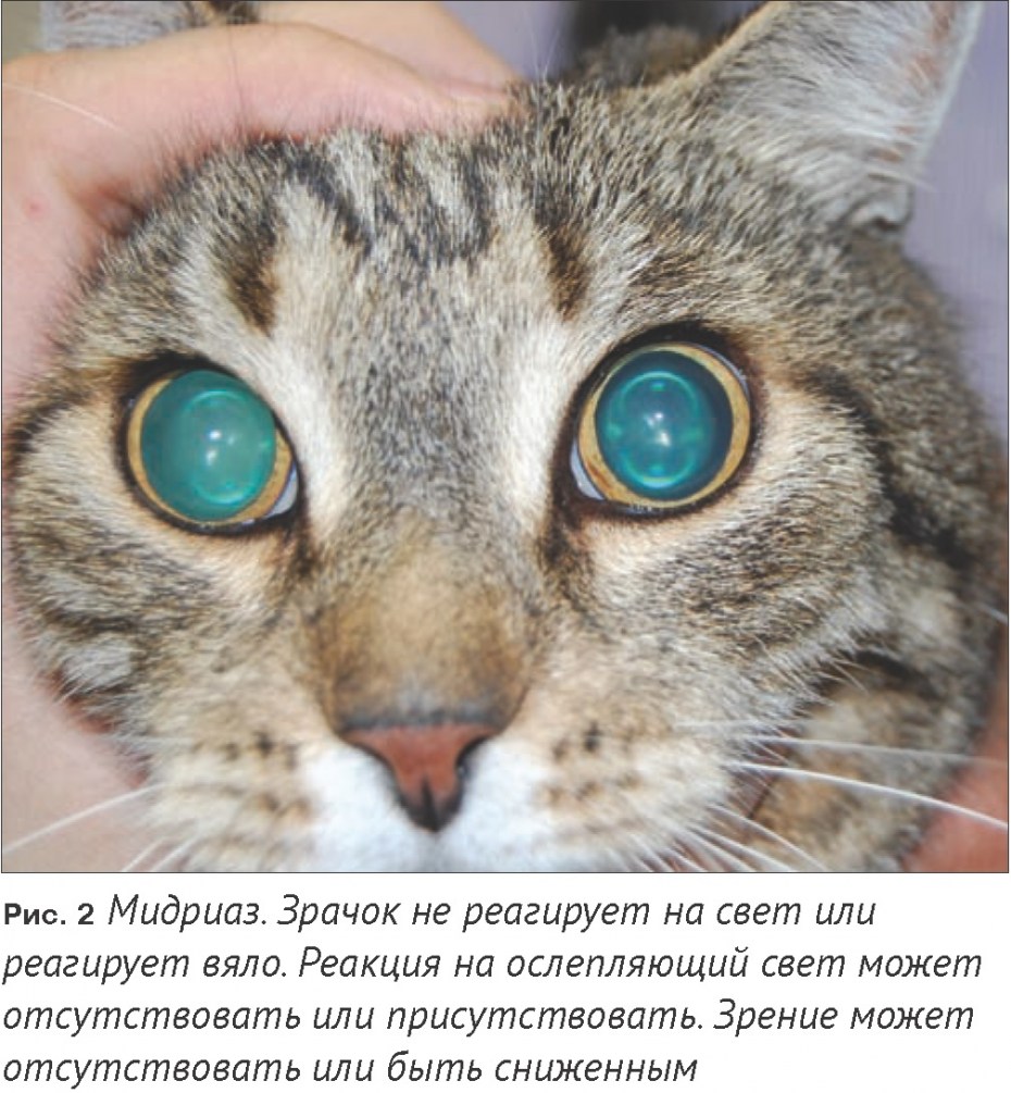 Кошачий зрачок расширенный