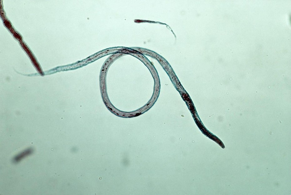Экскременты с нематодой Toxocara canis