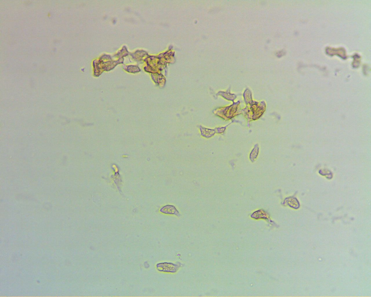 Простейшие в кале лечение. Цисты лямблий микроскопия кала. Струвиты и оксалаты. Цисты микроскопия. Трихомонады в моче под микроскопом.