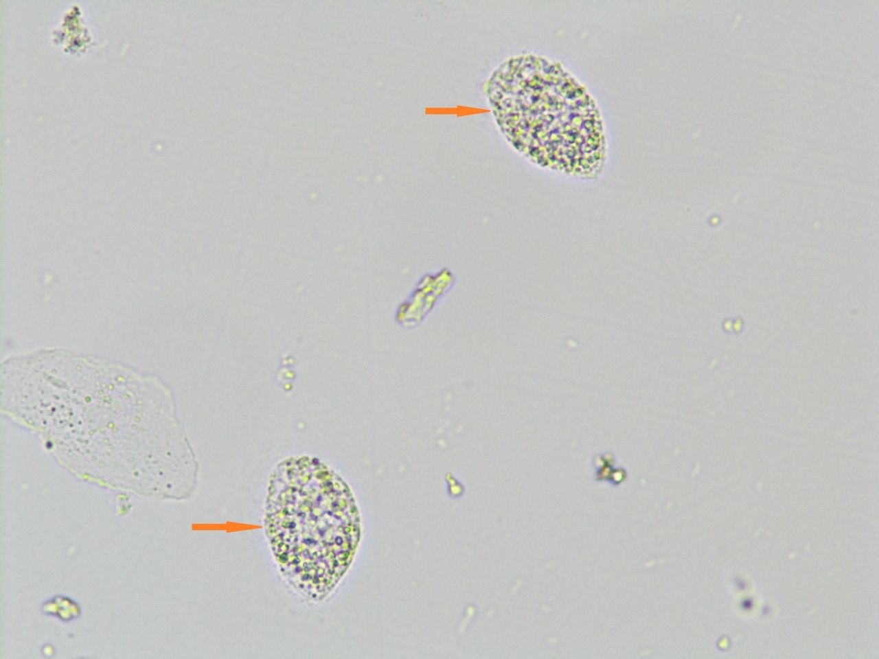Струвиты в моче. Трихомонады микроскопия нативный препарат. Трихомонады в моче микроскопия. Трихомонады в Кале под микроскопом. Трихомонады в нативном препарате.