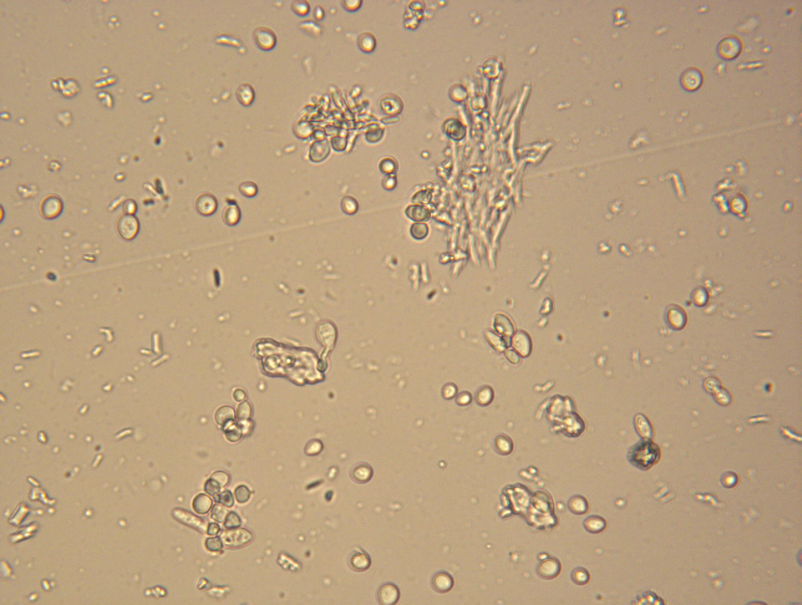 Капля слюны. Дрожжей Saccharomyces cerevisiae микроскопия. Дрожжи Saccharomyces микроскопия. Иммерсионная микроскопия дрожжей. Кандида микроскопия.