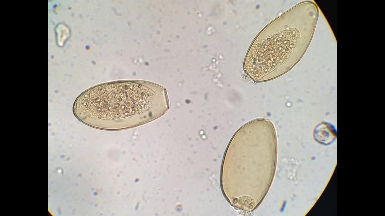 Яйцо печеночного сосальщика. Fasciola hepatica яйца. Яйца печеночного сосальщика. Яйца кошачьего сосальщика микроскоп. Яйца гельминтов Fasciola hepatica.