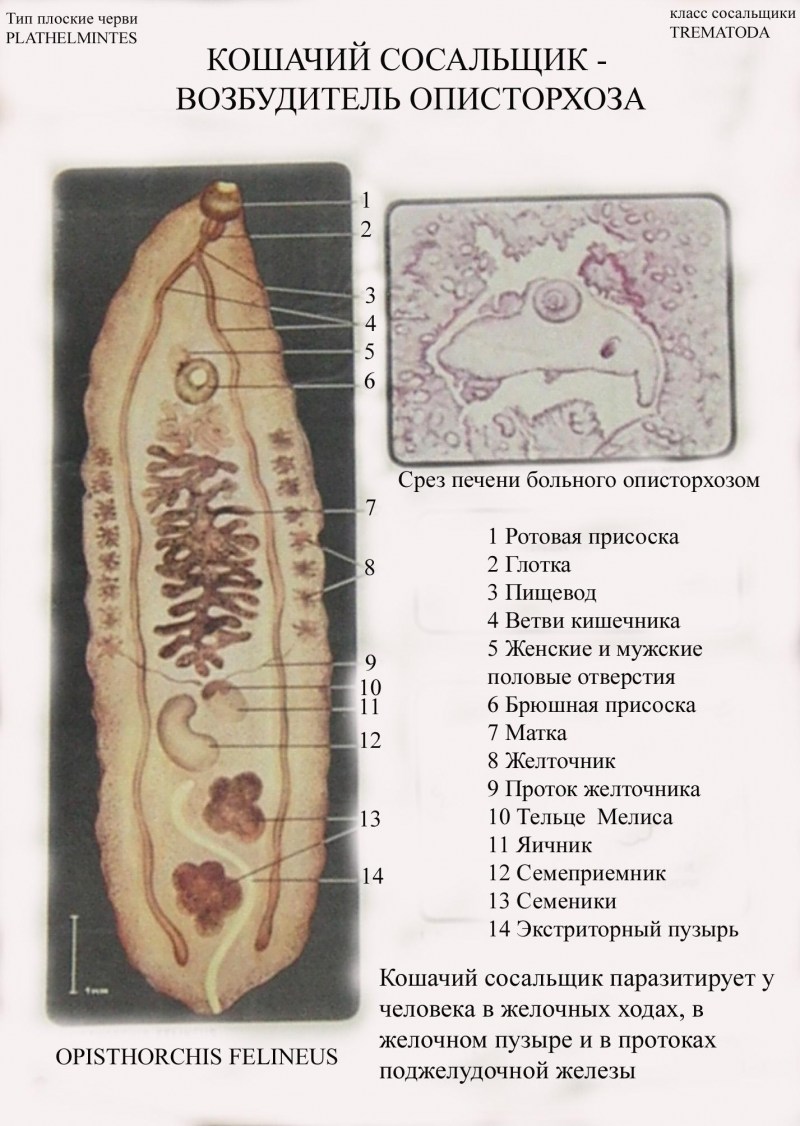 Описторхоз схема цикла развития