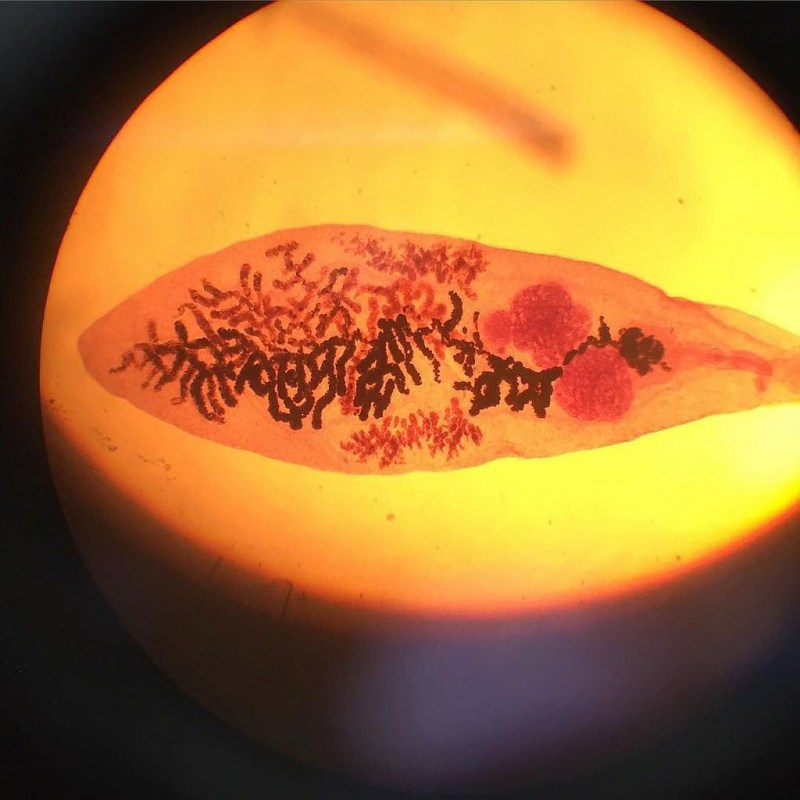 Clonorchis sinensis яйца