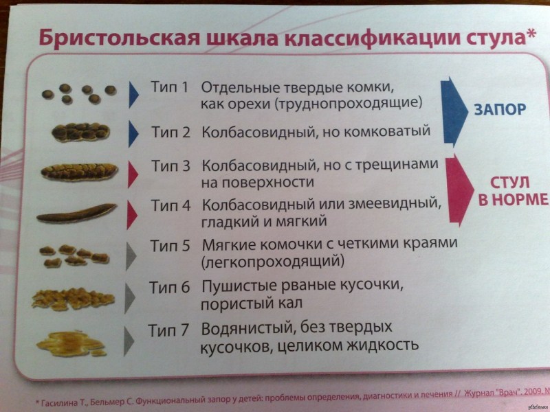 6 тип стула по бристольской шкале