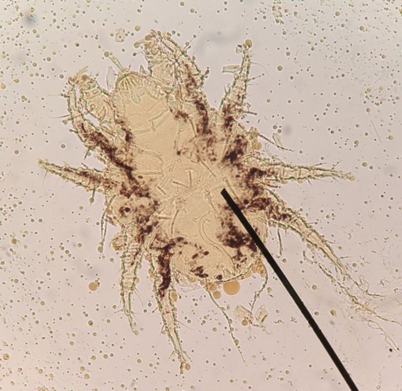 Чесоточный зудень (Sarcoptes scabiei)