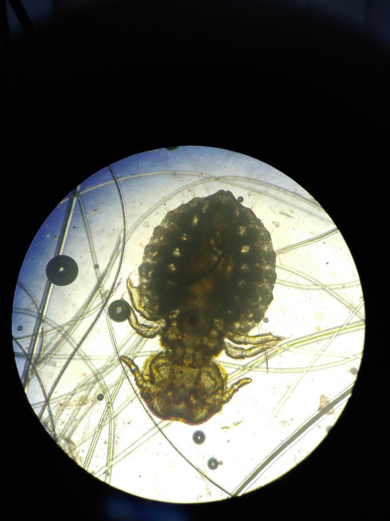 Pediculus humanus capitis строение