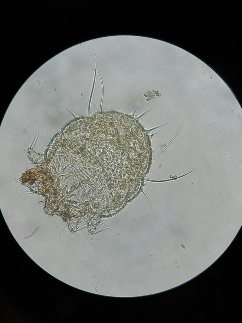 Чесоточный клещ Sarcoptes scabiei
