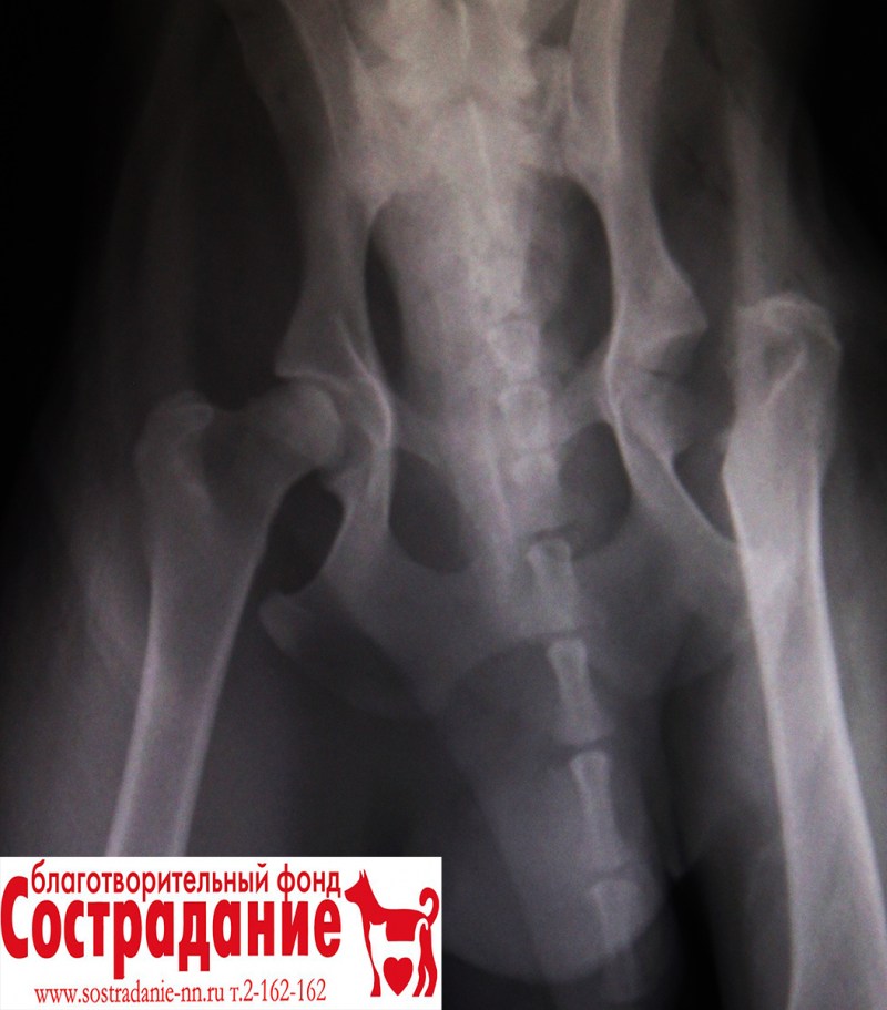 Подвывих головки бедренной кости