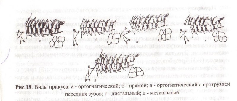 Центральная окклюзия ортогнатический прикус